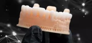 Fluxo digital em Implantodontia - JC Prótese Dentária